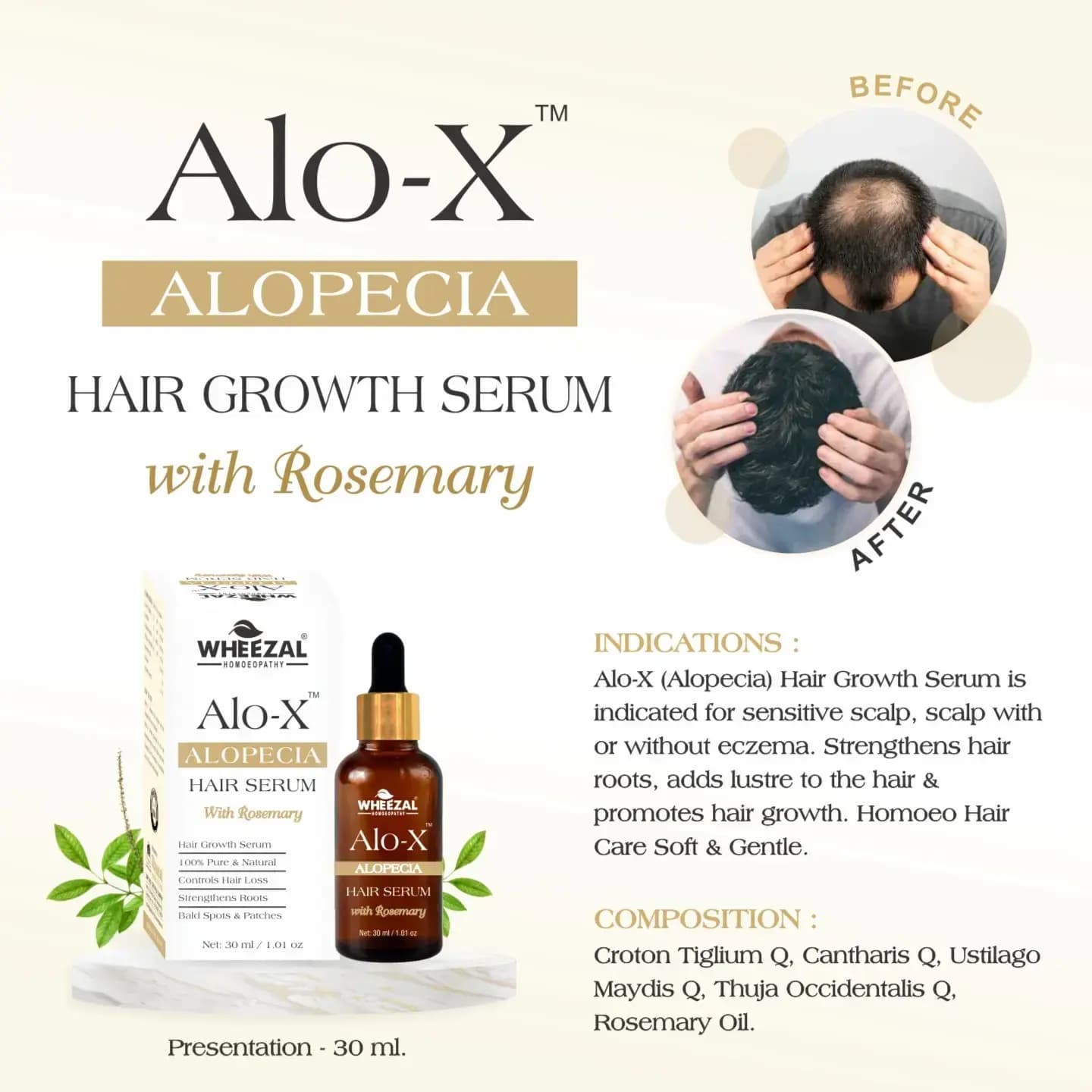 ALO X (ALOPECIA ) Hair Growth Serum Enriched with Rosemary Oil 5