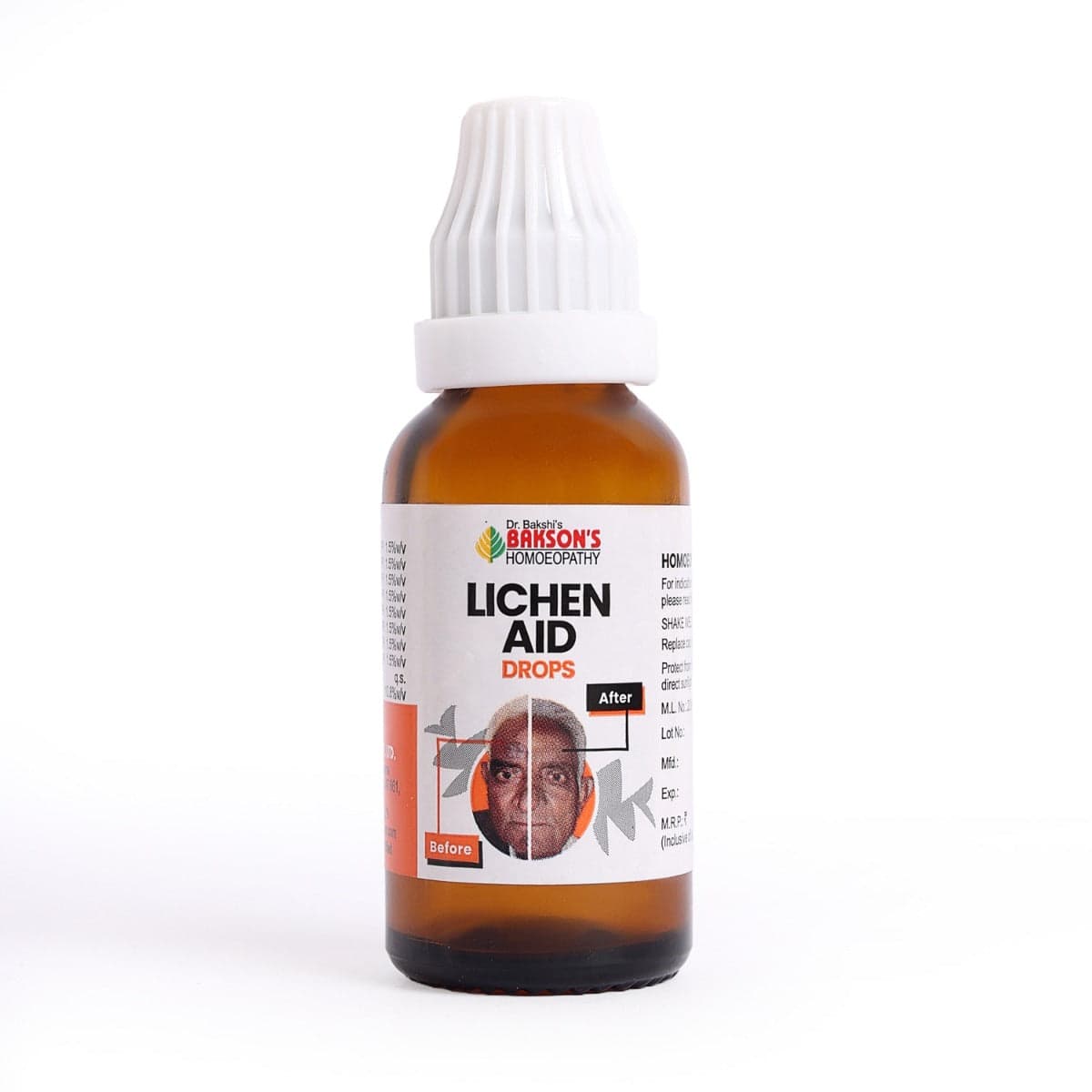 Lichen Aid Drops 30 ML 5