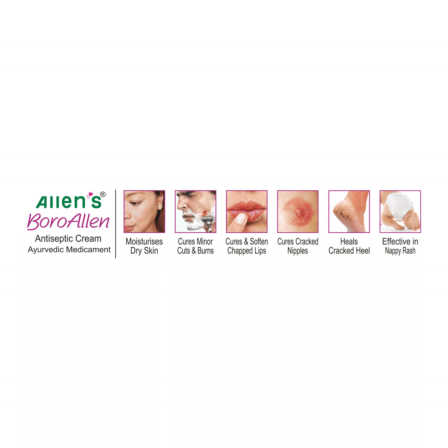 BoroAllen Antiseptic Cream 20 gm 5