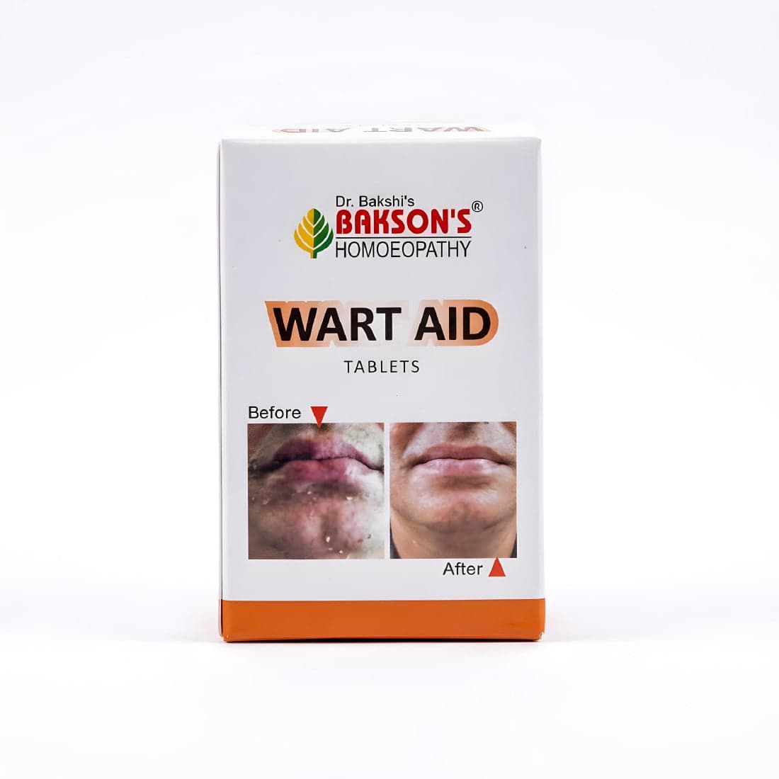 WART AID TABLETS 2