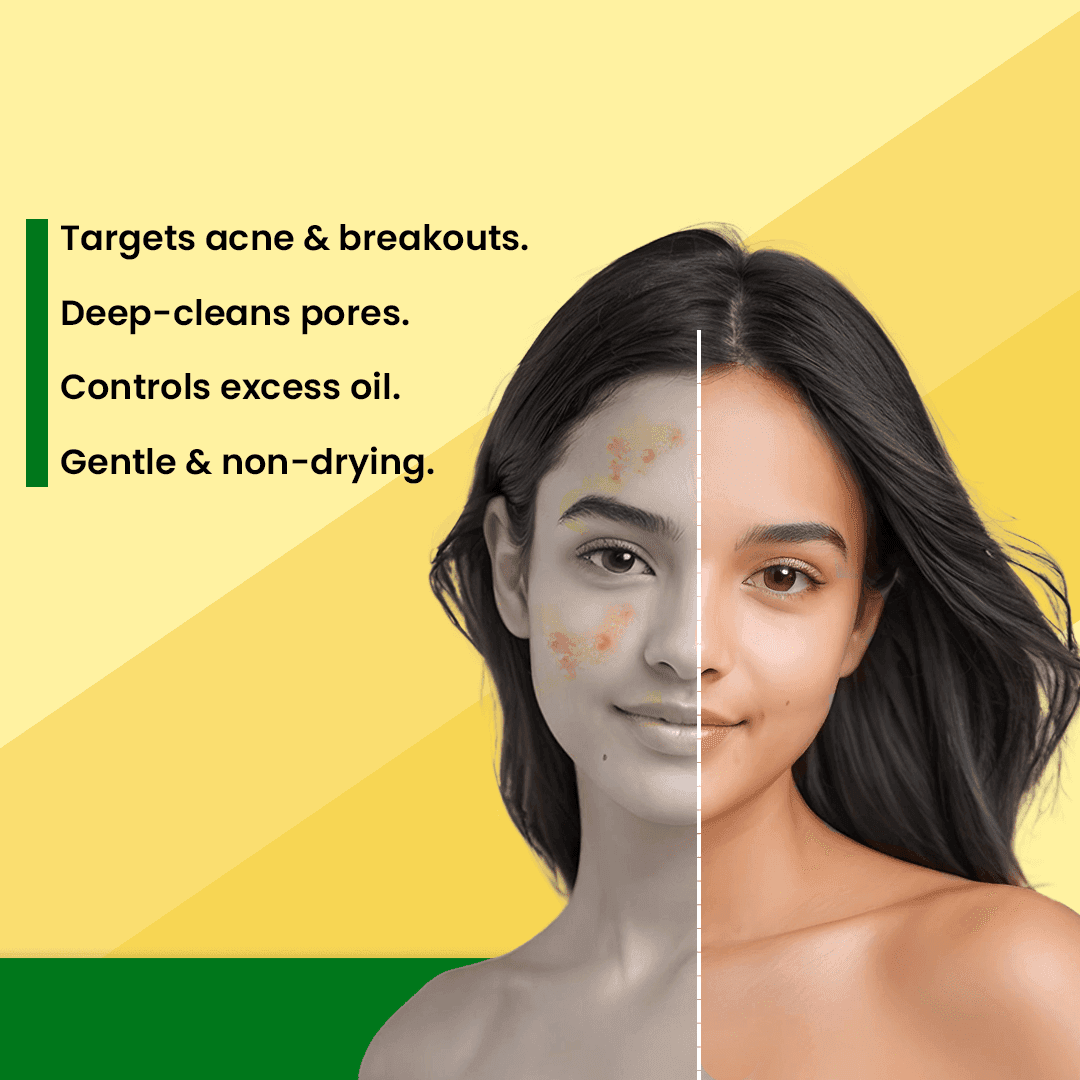 Adven Naturals D Acne Soap 7