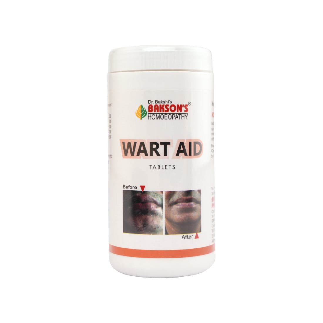 WART AID TABLETS 3