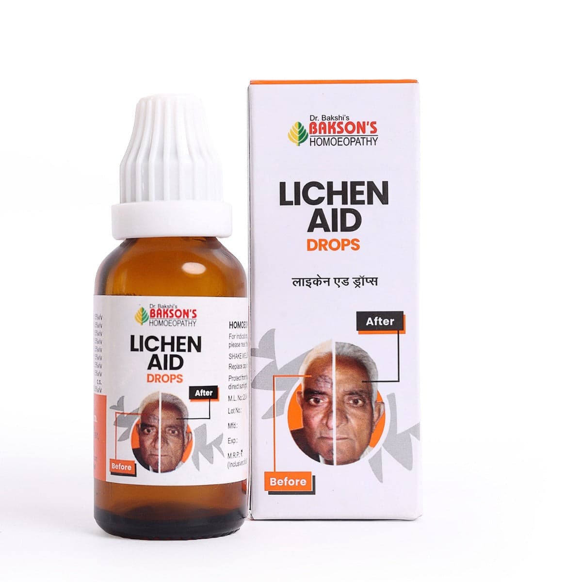 Lichen Aid Drops 30 ML 4