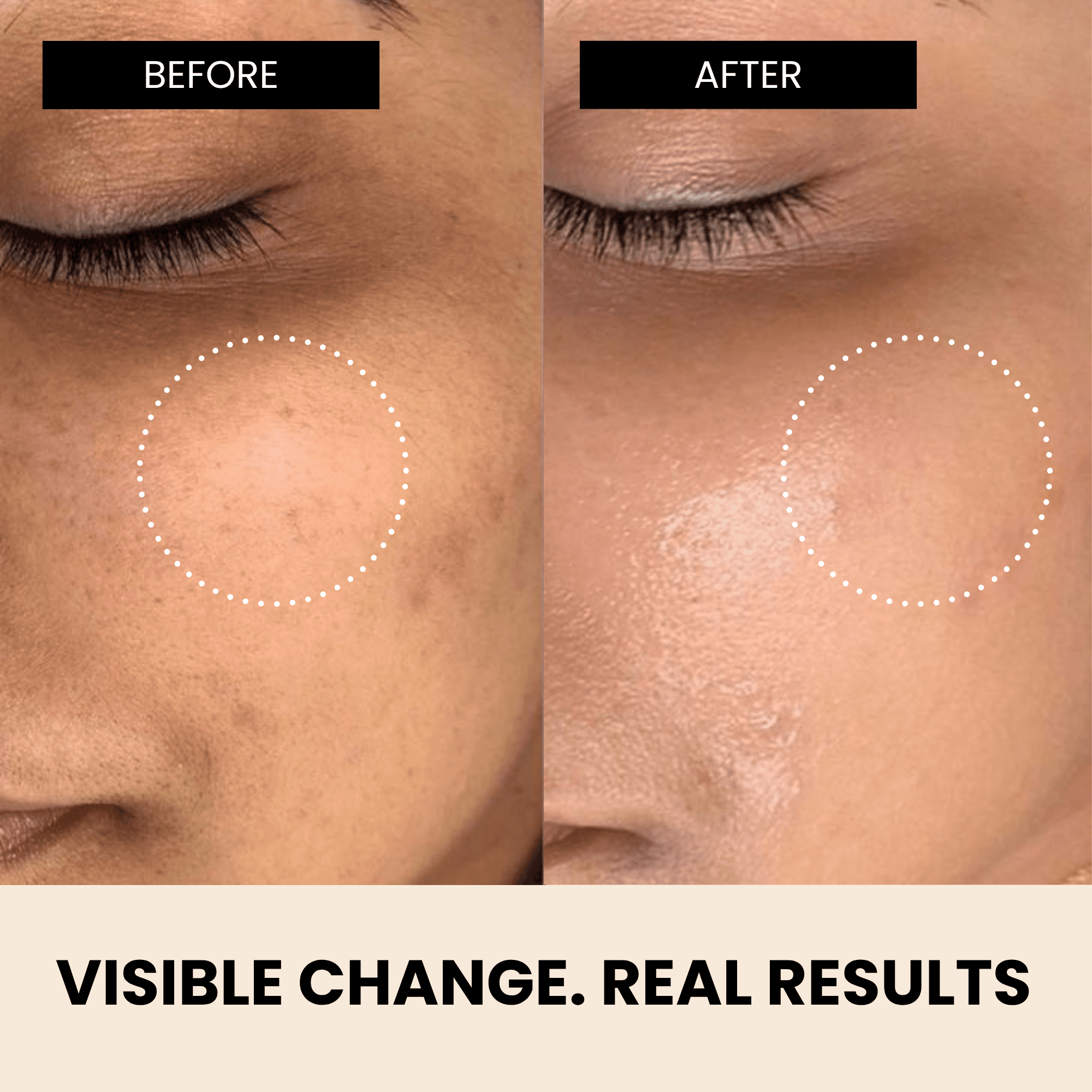 Richfeel Skin Brightening Day Serum 10 Ml 6