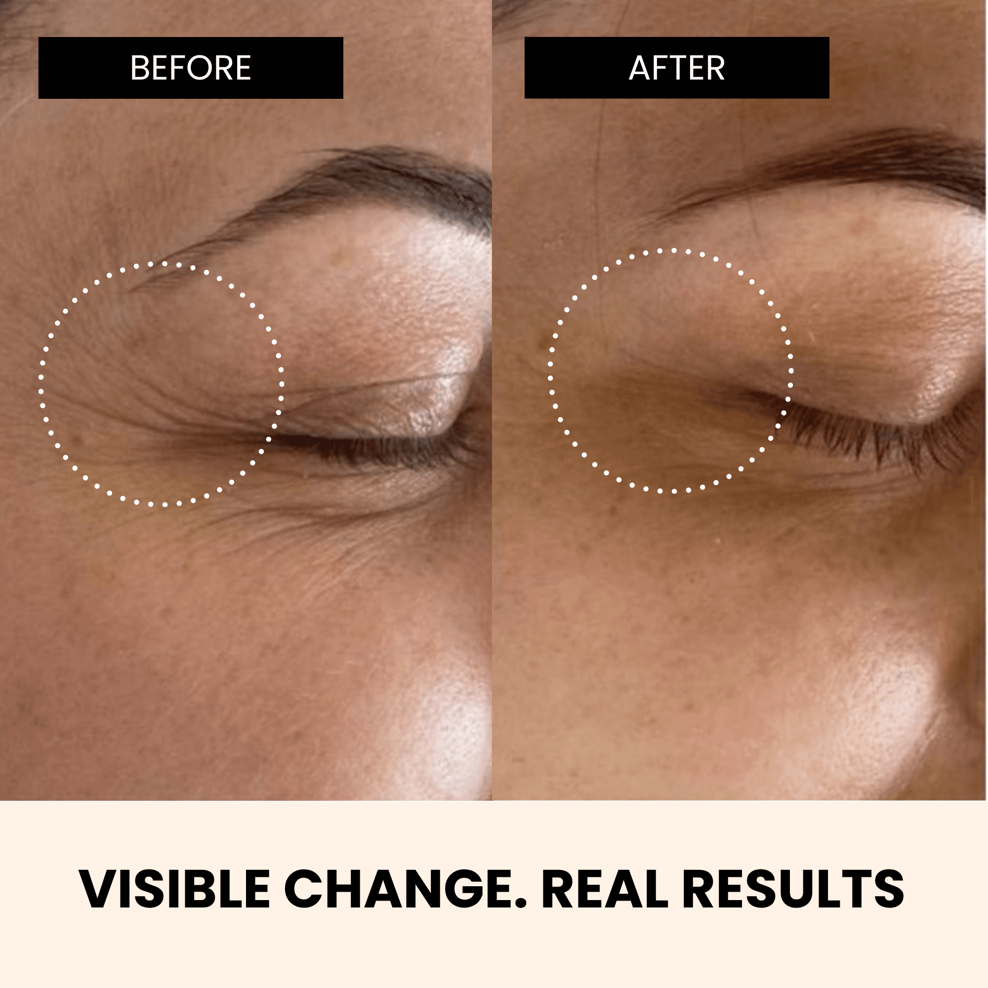 Richfeel Anti Ageing Night Repair Serum 10 Ml 5