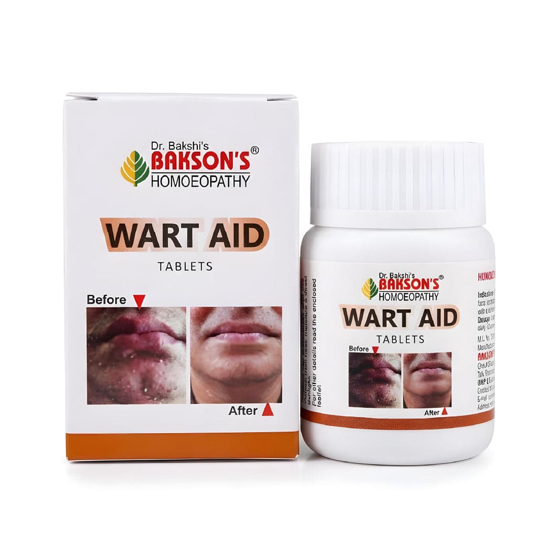WART AID TABLETS