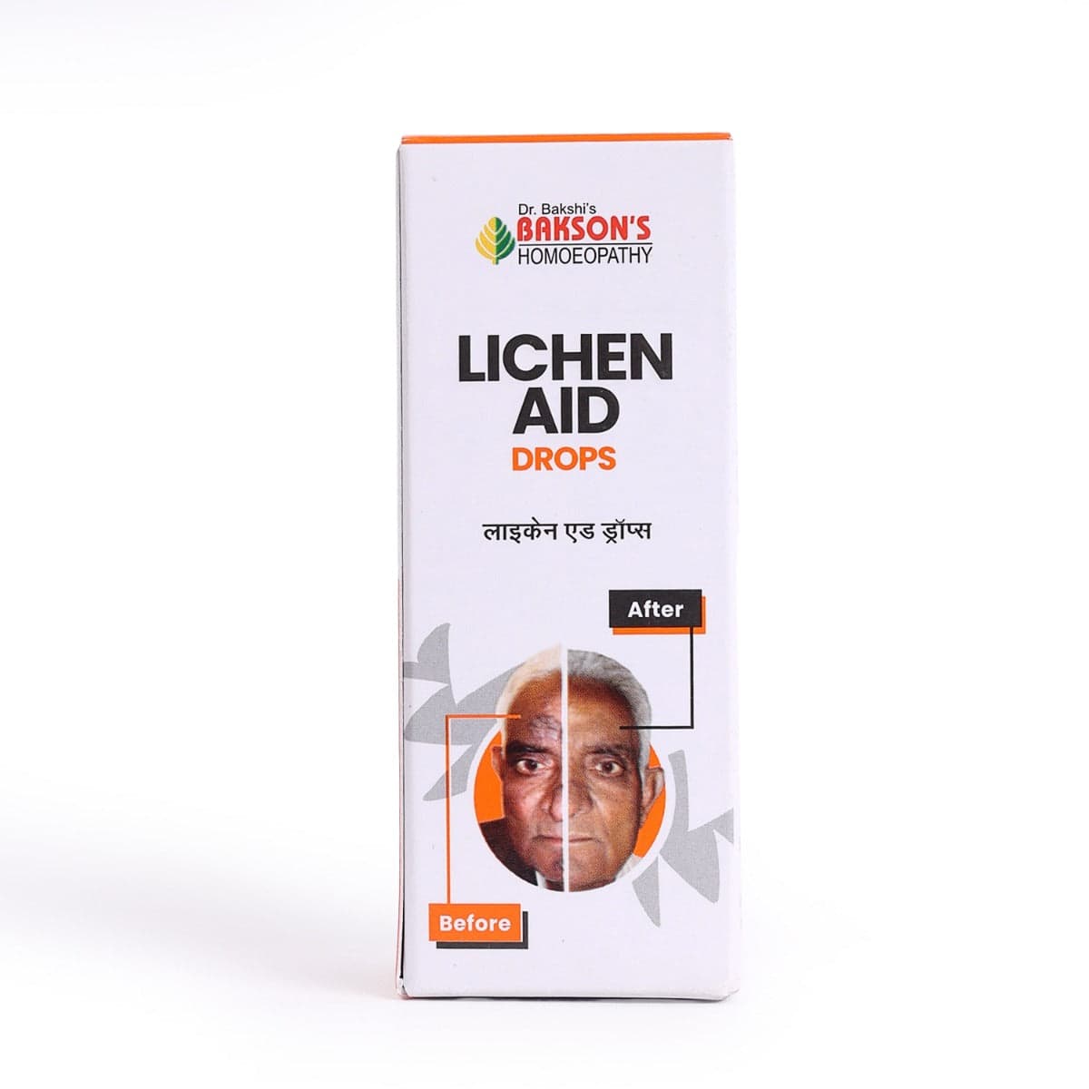 Lichen Aid Drops 30 ML